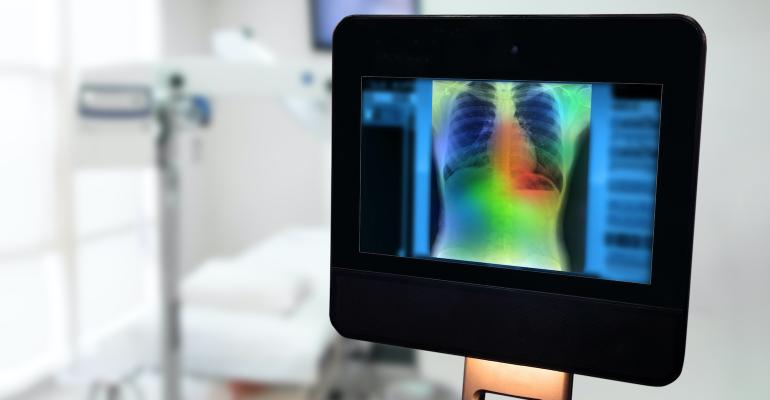 screen-showing-lungs-scan.jpg